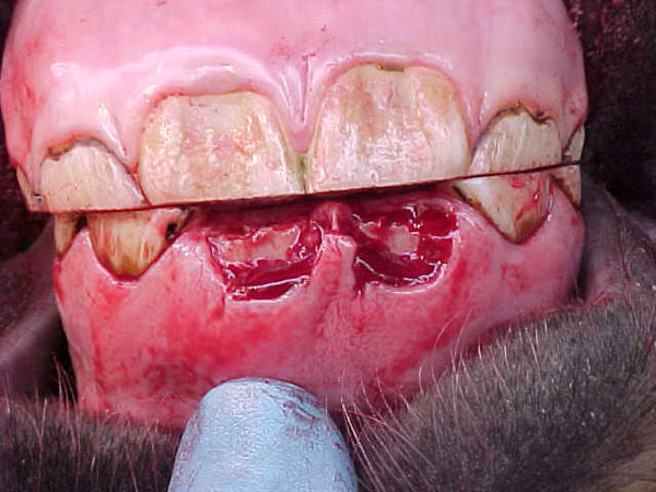 incisor16 retained roots